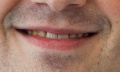Philippe's Teeth.jpg